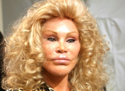 Jocelyn Wildenstein
