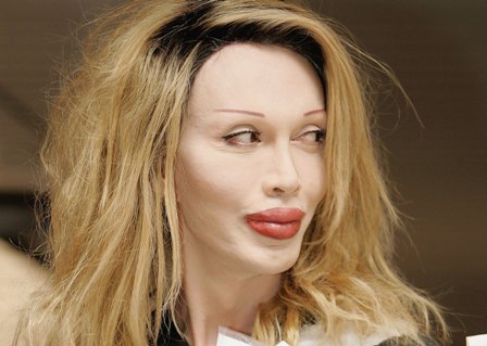Pete Burns